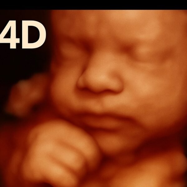 4D Ultrasound image of a baby