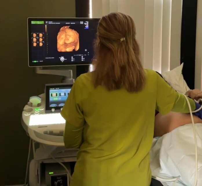 Image of a pregnacy care center bonding session at Baby's First Glance Ultrasound Studio in San Jose CA